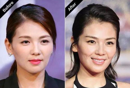 凹脸明星图,独特面容下的魅力解析