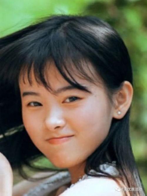 网红大眼睛美女整容,网红颜值的秘密武器